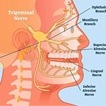 Trigeminal pain